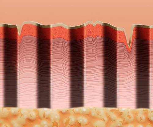 skin results from procedure