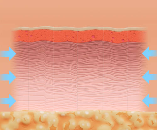 results from Ellacor micro-coring